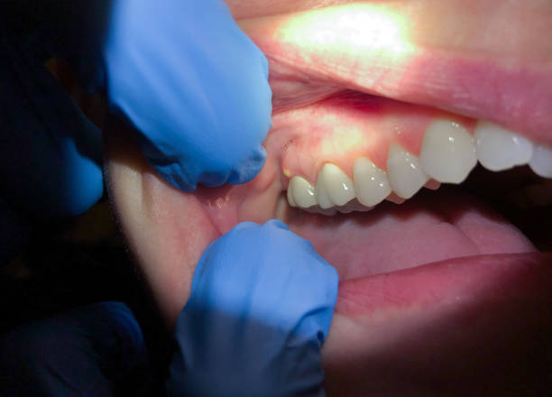 Best Knocked-Out Tooth Emergency  in North Massapequa, NY